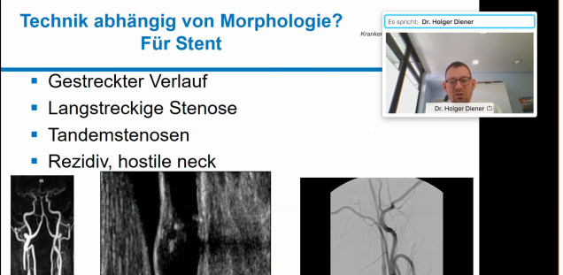 Seminareinblick Gefäßchirurgie