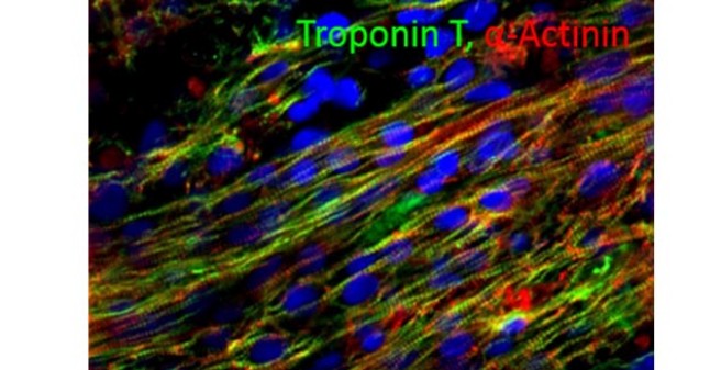 Herzzellen fluoreszent