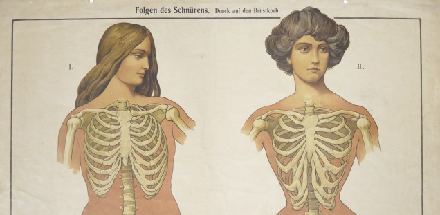 Schulwandtafel mit der Abbildung der anatomischen Folgen zu enger Corsagen