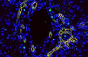 Institut für Experimentelle Immunologie und Hepatologie