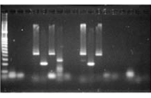 PCR