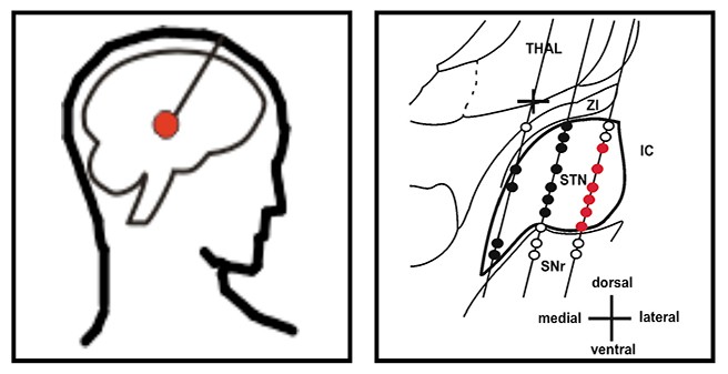 Research Group "Basal Ganglia Neurophysiology"