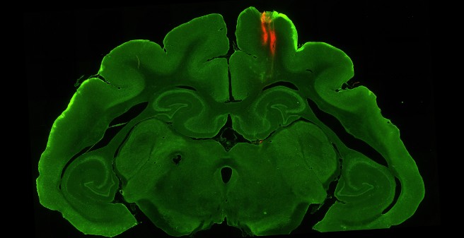 Research Group "Decision Neuroscience"