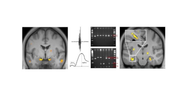 Research Group "Fear, anxiety and stress"