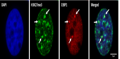 PCa cells