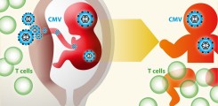 Congenital Cytomegalovirus infection