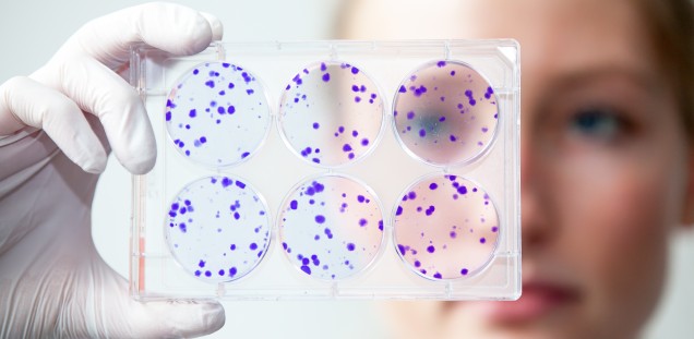 Überlebensrate nach Bestrahlung mittels Colony-Formation-Assay