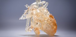  3D-Modell eines Patientenherzens zur OP-Vorbereitung