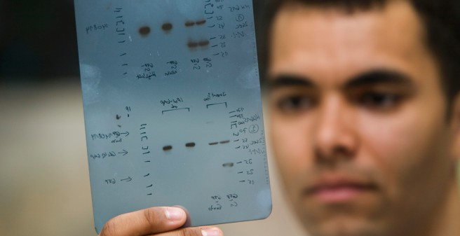 Analysenauswertung im Institut für Neuropathologie