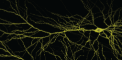 CA1 pyramidal neuron